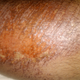 Illustration for article titled There Are So Many Ways To Make Your Leg Turn Purple